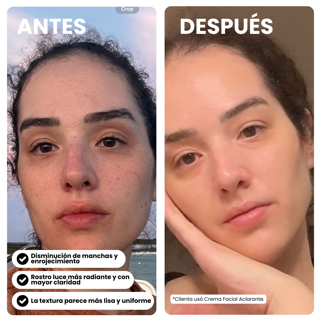 Crema Facial Aclarante