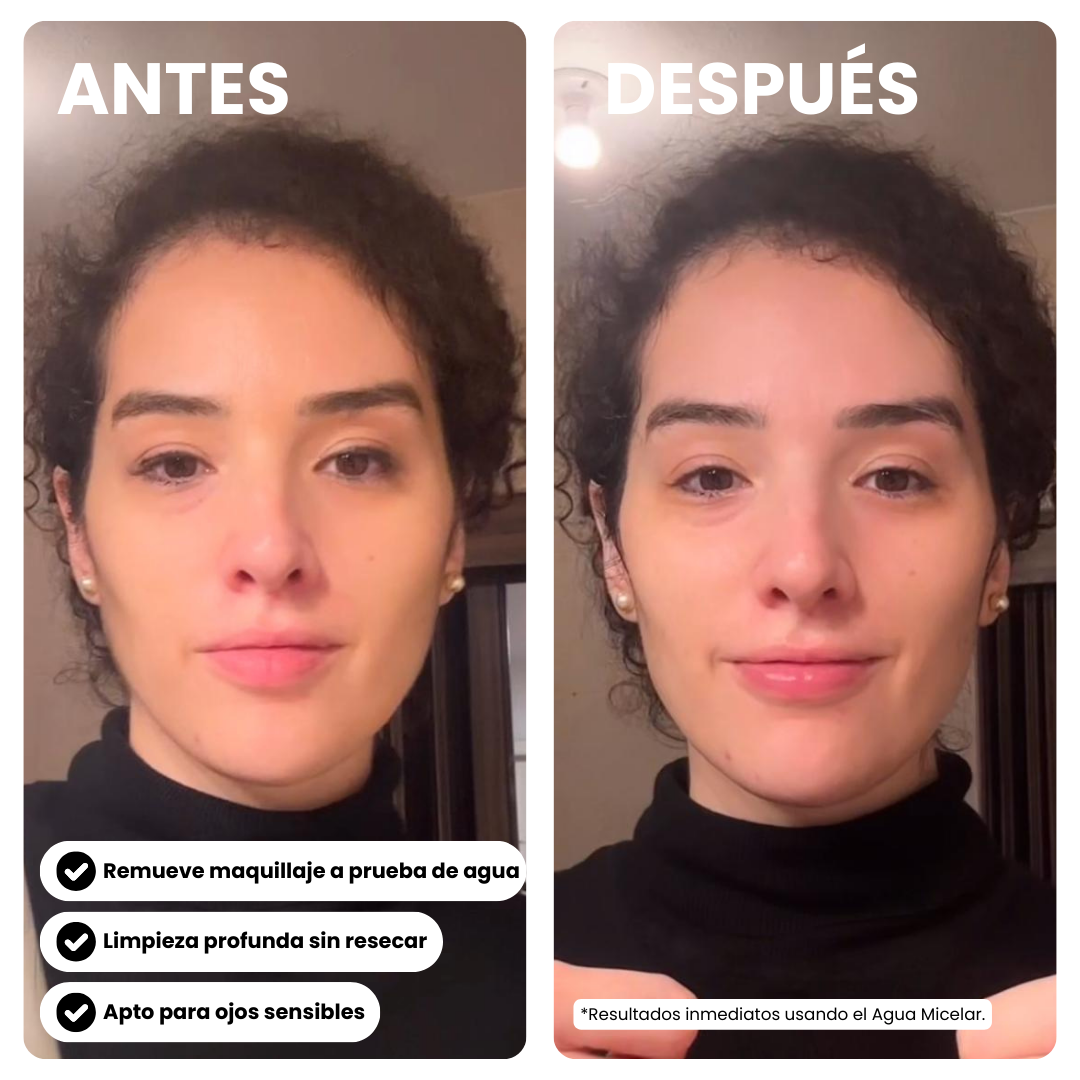 Agua Micelar Desmaquillante