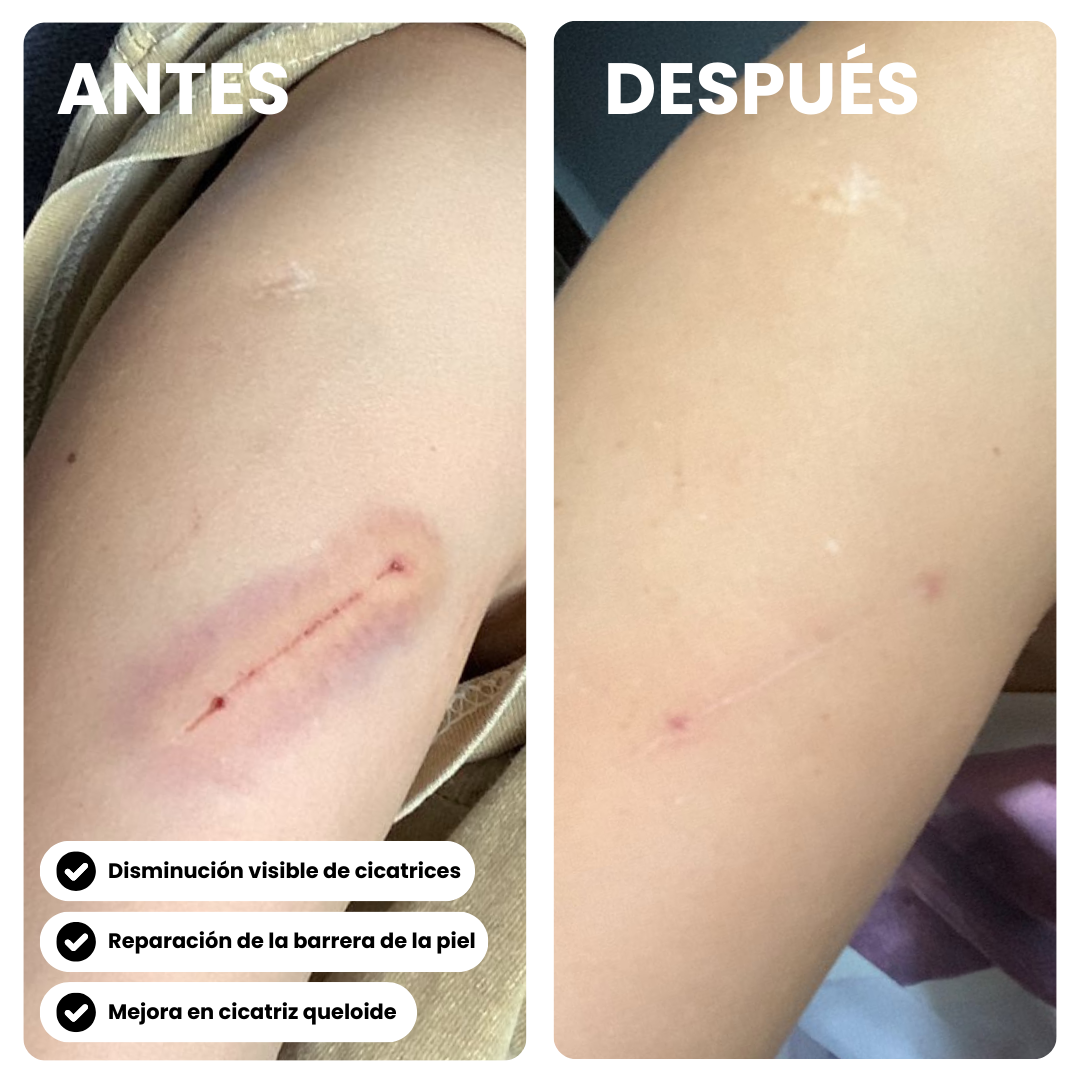 Full Recovery Bundle