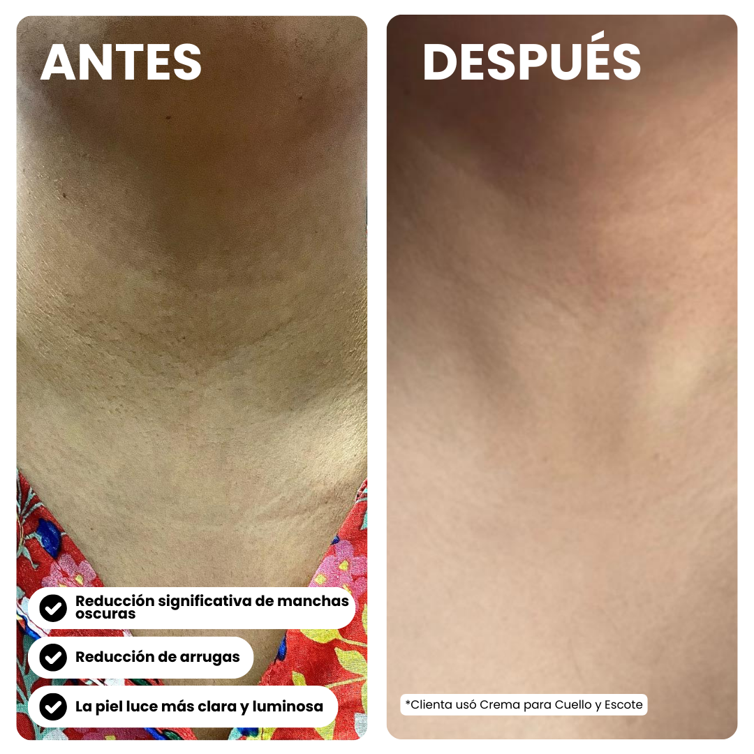 Crema Cuello & Escote