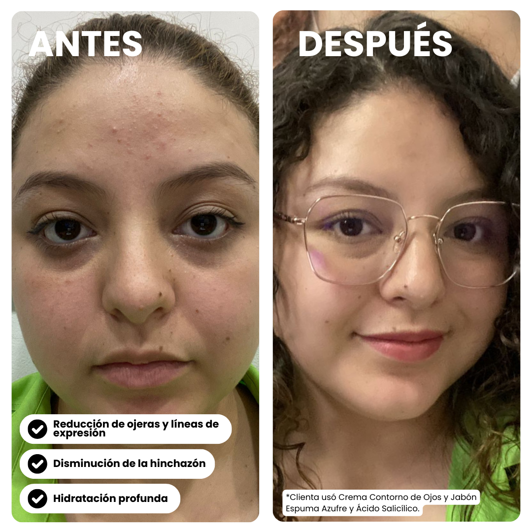 Crema Contorno de Ojos