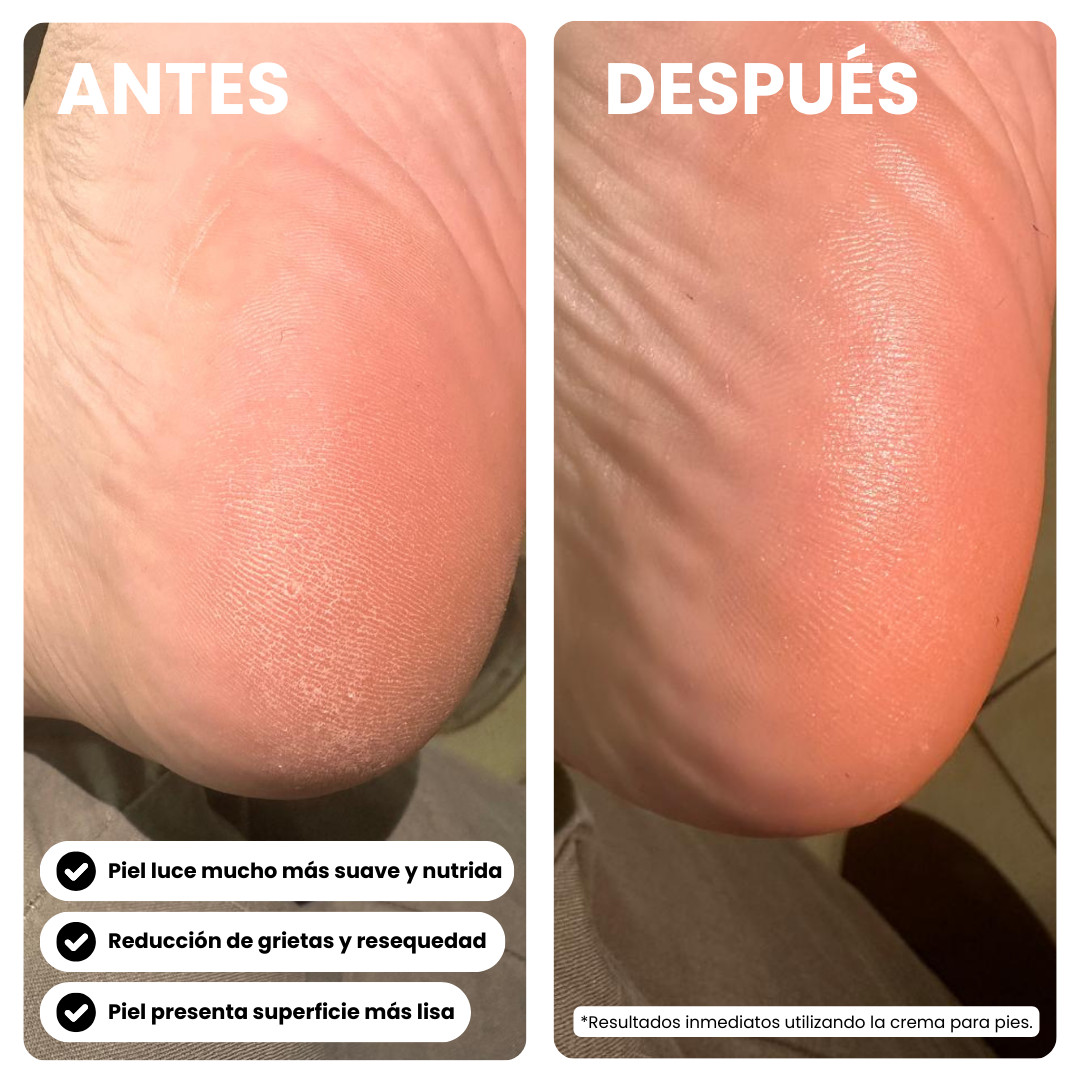 Crema para Pies con Caviar, Urea & Manteca de Karité