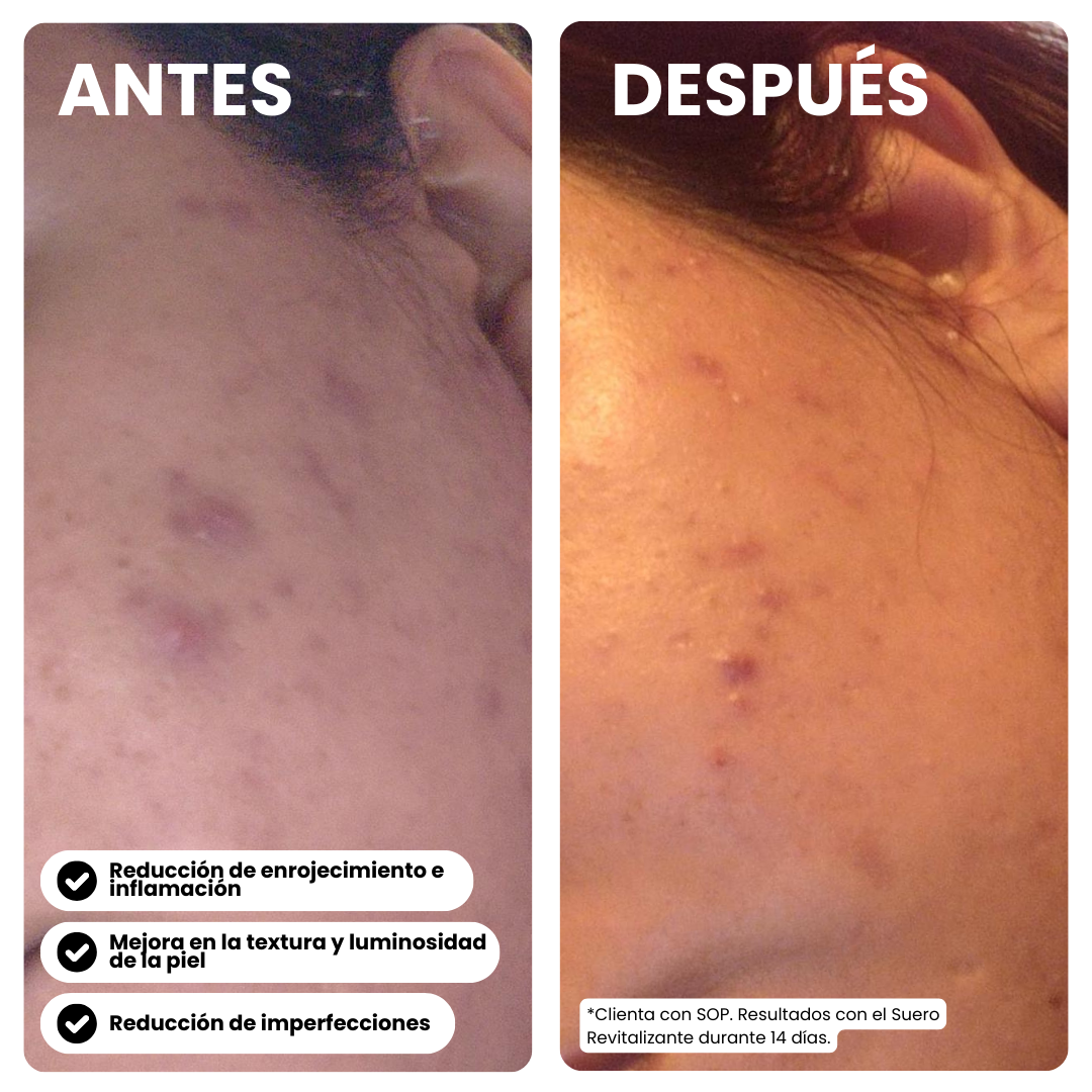 Suero Facial Revitalizante