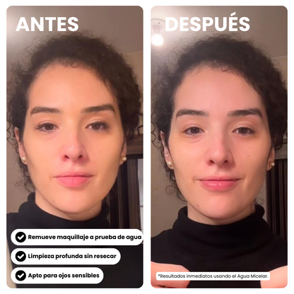 Agua Micelar Desmaquillante