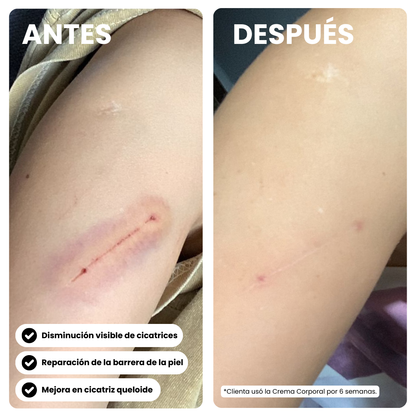 Crema Corporal Reparación Intensiva