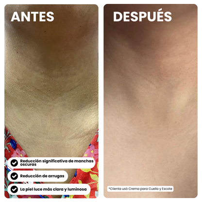 Crema Cuello & Escote
