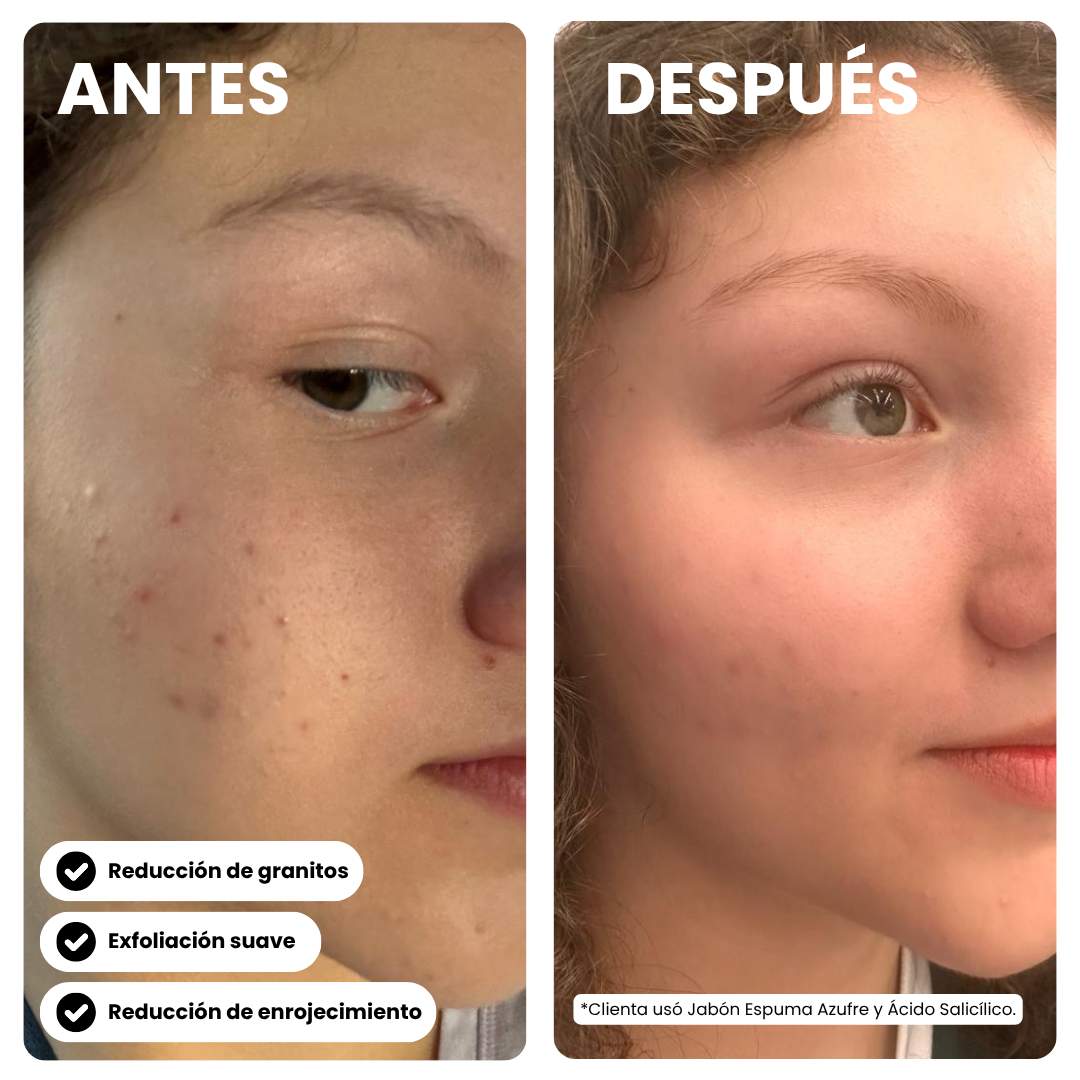 Kit Clear Skin