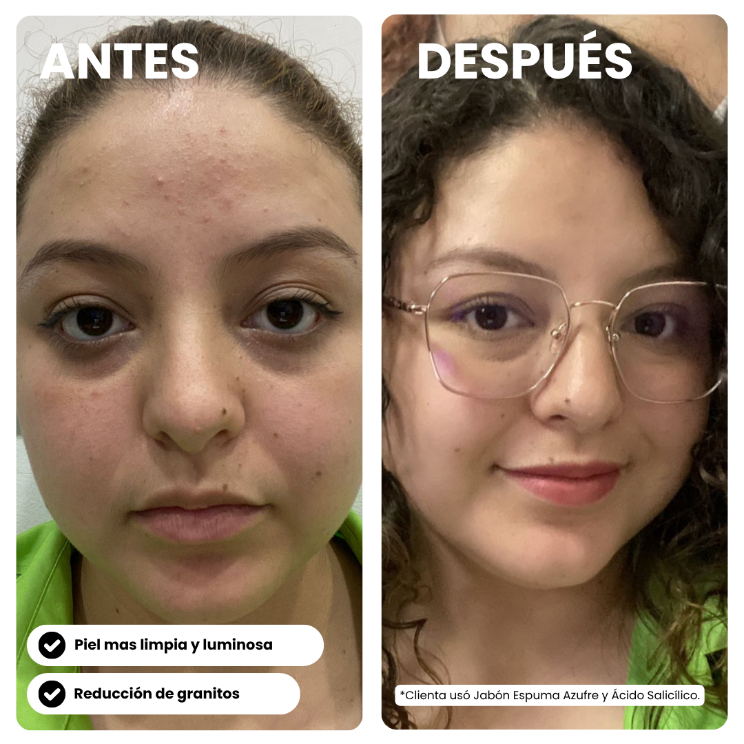 Kit Clear Skin