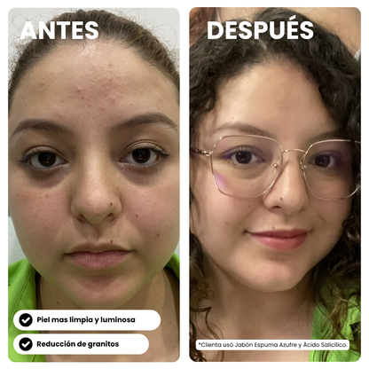 Kit Clear Skin
